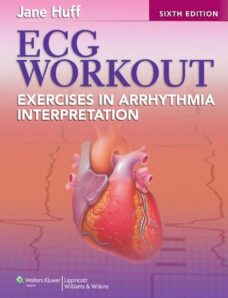 Exercises in Arrhythmia Interpretation by Jane Huff