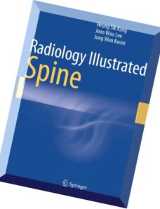 Radiology Illustrated Spine