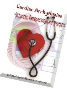 Cardiac Arrhythmias Mechanisms, Pathophysiology, and Treatment