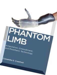 Phantom Limb Amputation, Embodiment, and Prosthetic Technology