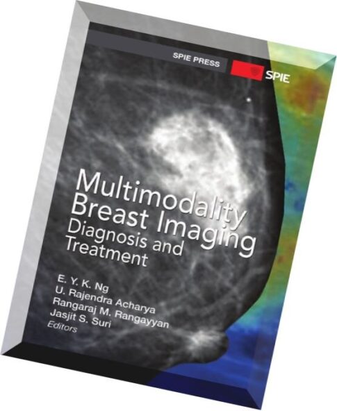 Multimodality Breast Imaging Diagnosis and Treatment