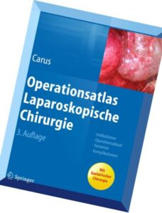Operationsatlas Laparoskopische Chirurgie Indikationen – Operationsablauf – Varianten – Komplikation