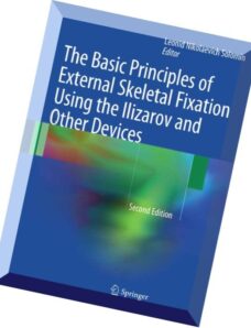 The Basic Principles of External Skeletal Fixation Using the Ilizarov and Other Devices, 2nd edition